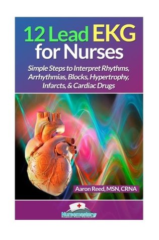 Read 12 Lead EKG for Nurses: Simple Steps to Interpret Rhythms, Arrhythmias, Blocks, Hypertrophy, Infarcts, Cardiac Drugs - Aaron Reed MSN | PDF