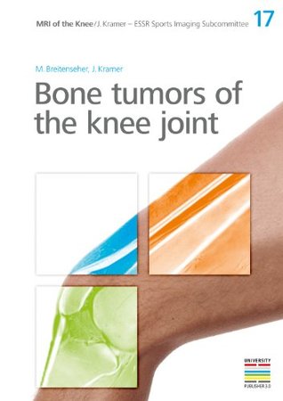 Read 17. Bone tumors of the knee joint (MRI of the Knee/J. Kramer) - M. Breitenseher | ePub